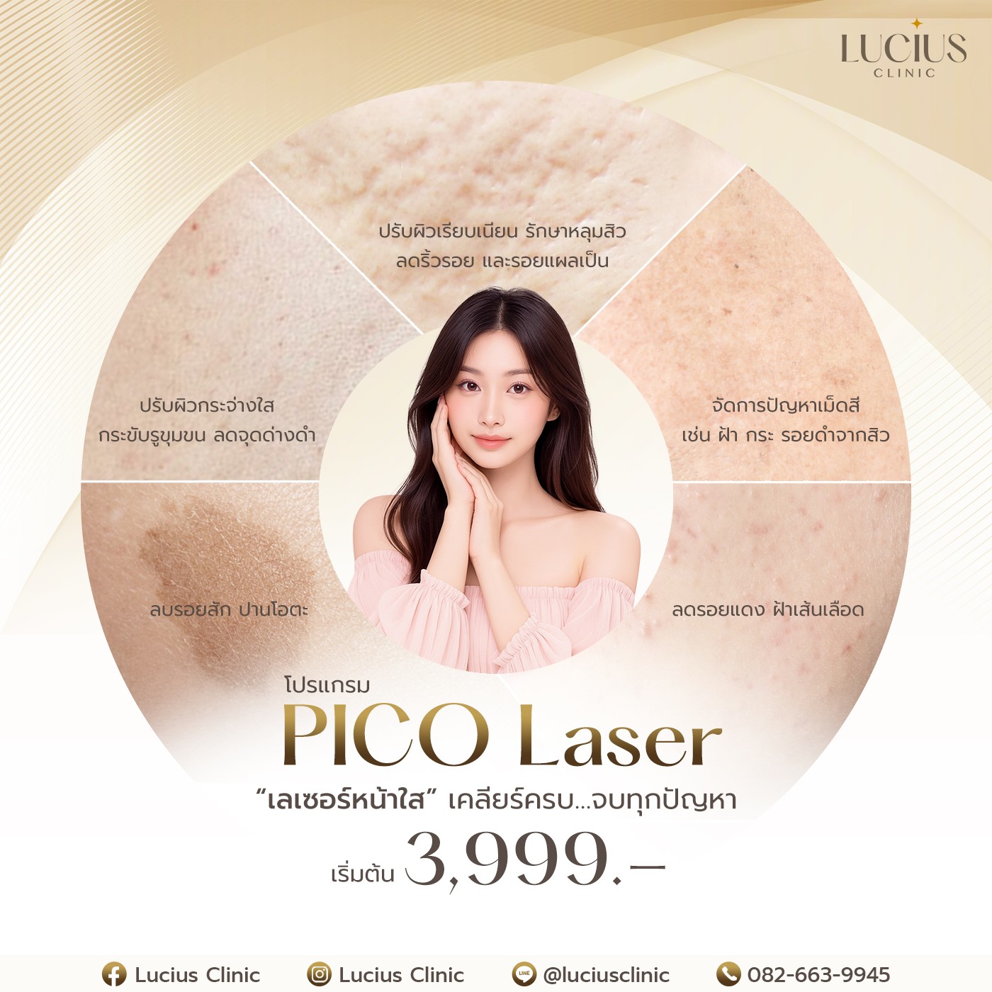 Picosecond Laser