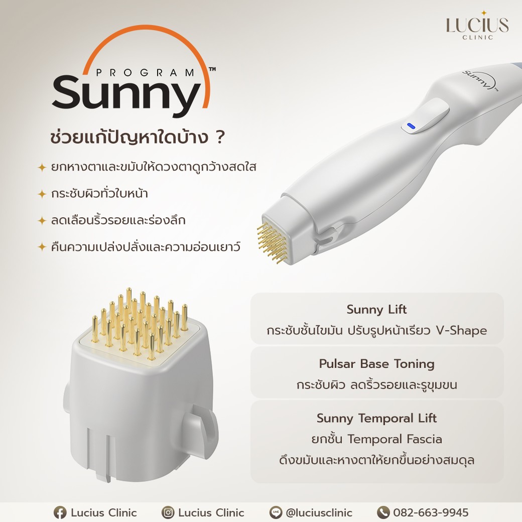Sunny Mechanism