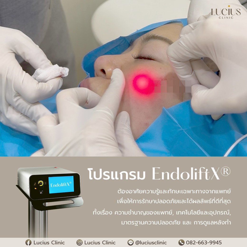 EndoliftX